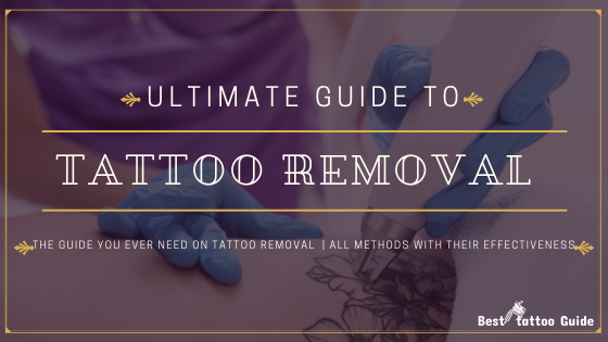 ultimate-guide-to-tattoo-removal-7932406