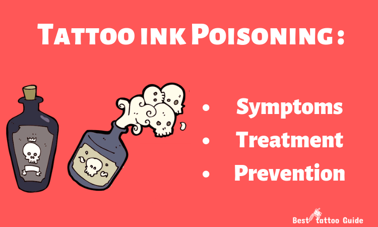 tattoo-ink-poisoning-9571542